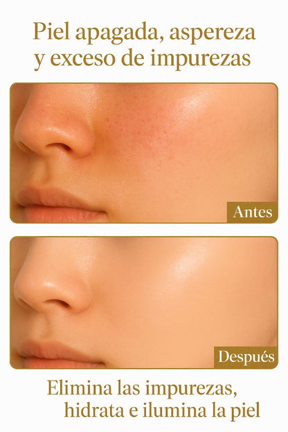 CREMA FACIAL HIDRATANTE PROFUNDA – ILUMINADORA CON NIACINAMIDA Y ARROZ