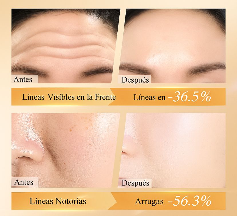 REDUCE ARRUGAS EN POCAS SEMANAS